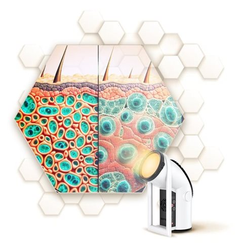 Прорив у лікуванні ПСОРІАЗУ: ЛІКУВАННЯ ГІПЕРСВІТЛОМ BIOPTRON®